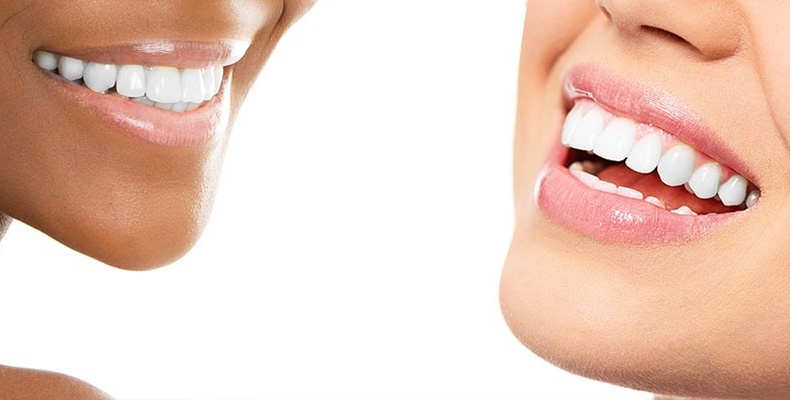 Cosmetic Dentistry